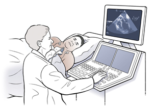 Man lying on side on exam table with EKG leads on chest. Technician is holding ultrasound probe to man's chest. 