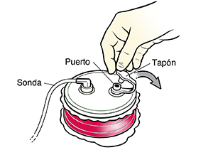 Primer plano de una mano enguantada que abre el tapón de un drenaje Hemovac completo.